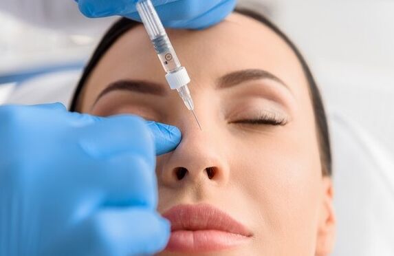 The method of non -surgical rhinoplasty