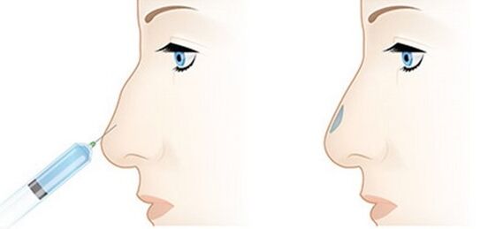 The procedure allows you to adjust various problems