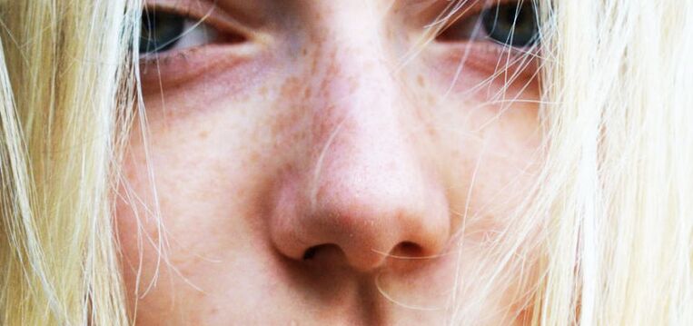 Woman's nose