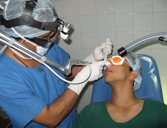 correction of the septum using a laser scalpel